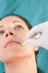 Leukoplast skin adhesive 0,7 ml 10 Stk.