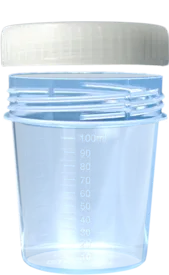 Becher 100ml mit Verschluss AP 5x50 mit Graduierung, PP